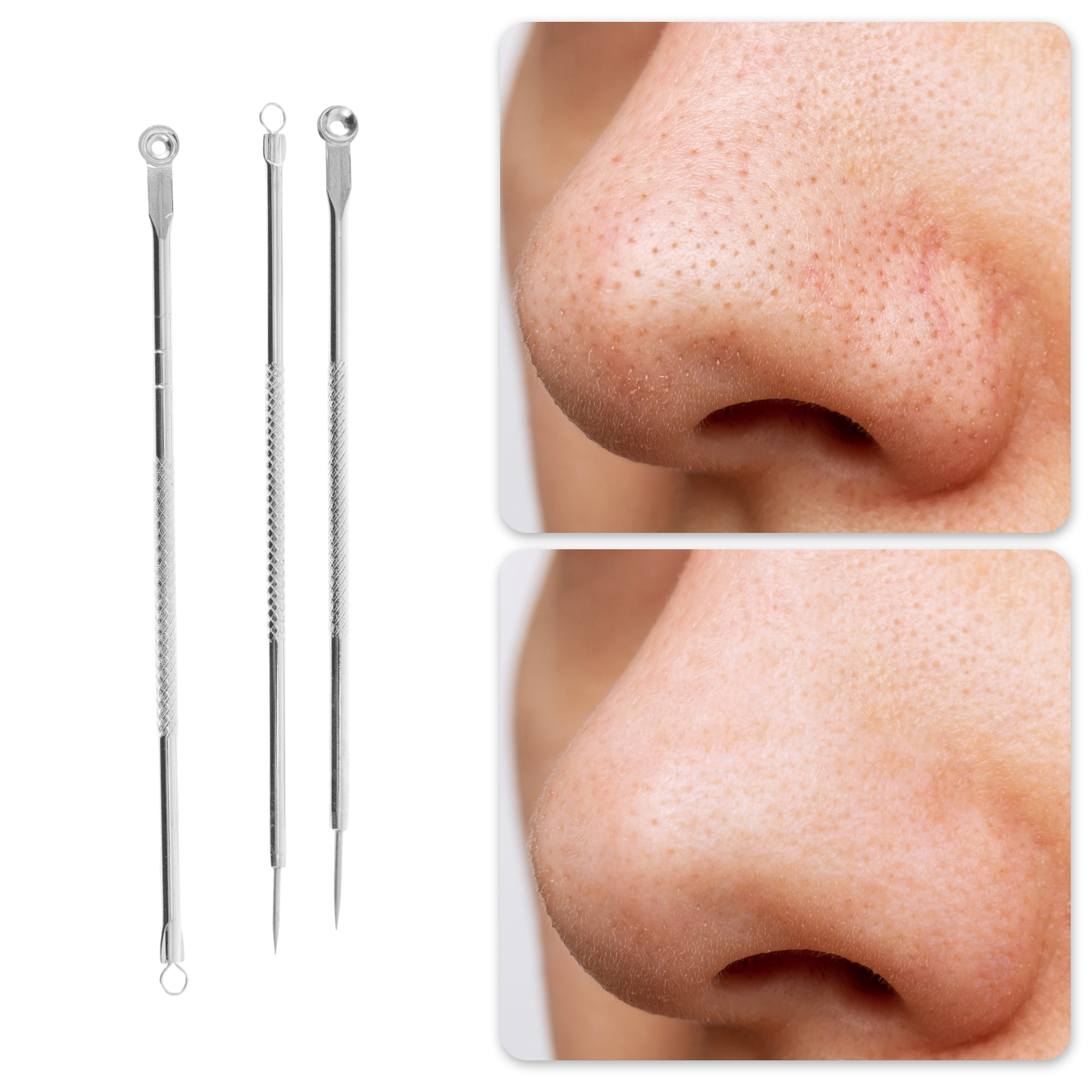 Unique Bargains Professional Stainless Steel Pimple Extractor Tool Kit Silver Tone
