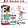 thumbnail image 3 of Fungal Nail Treatment For Toenails Extra Strong,nail Fungus Treatment For Toenail,toenail Fungus Treatment, 3 of 5