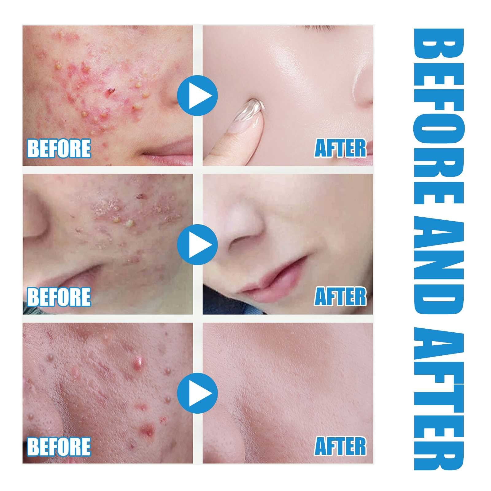 Korean Face Care Antioxidant Facial for Glowing Face Lip Lip Plumper Skinb5 Korean Face Products Power Dry Reverse Regimen for Face Lift Skin Texture Smoother Face Jawline Enhancer Organic Peptide