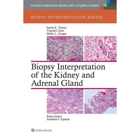 Biopsy Interpretation: Biopsy Interpretation of the Kidney & Adrenal Gland (Hardcover)