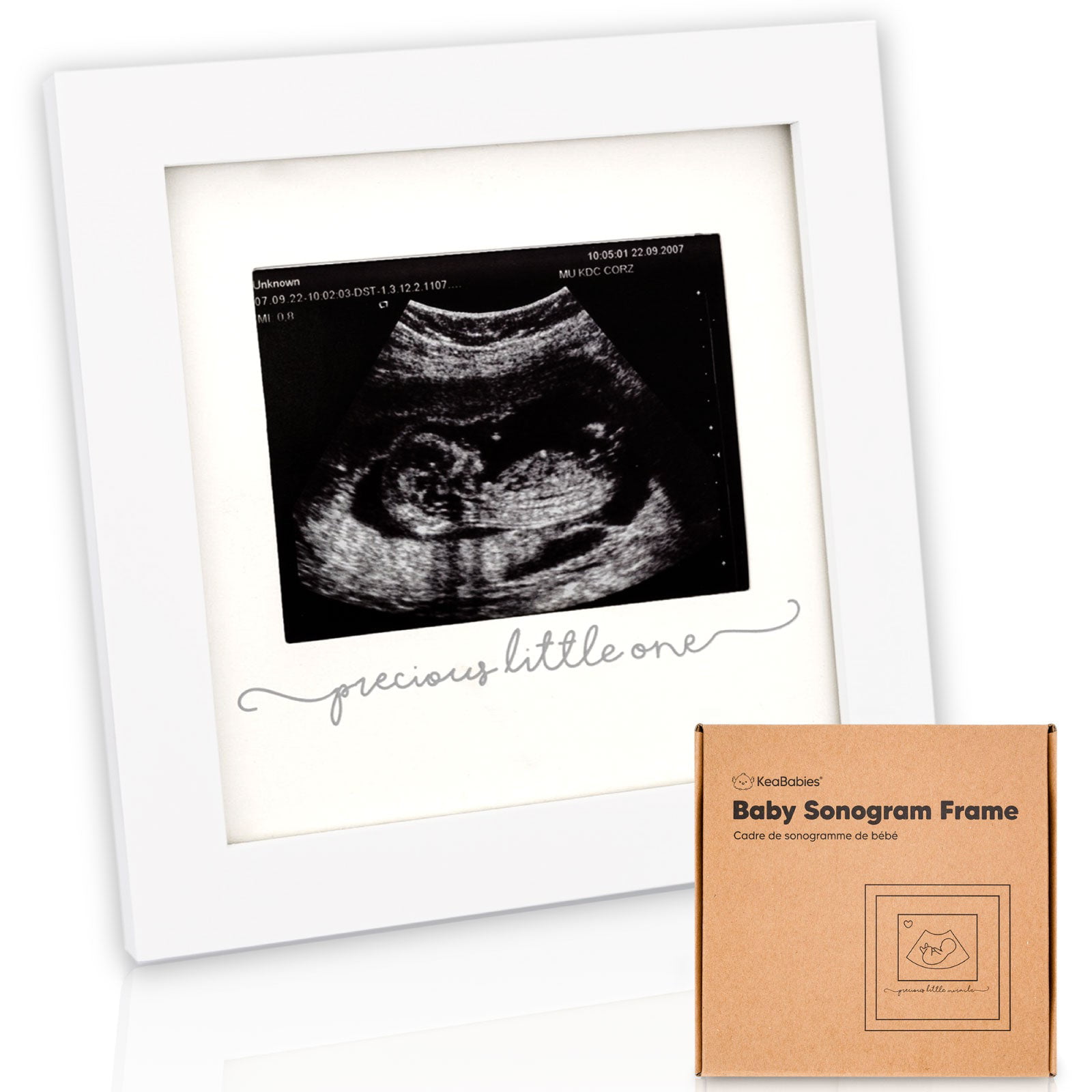 Baby Scan Photo Frame Vinyl Sticker for DIY Box Frame Coming Soon Sticker only 