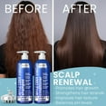 thumbnail image 7 of Apple Cider Vinegar Shampoo and Conditioner Set | Deep Cleansing, Frizz Control, Shine Restoration & Scalp Care, 7 of 7