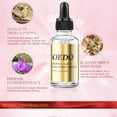 thumbnail image 5 of Lenkho Nail Fungus Liquid, Fungal Nail Polish for Toenails & Fingernails, Nail Treatment Oil, Supports Nail Growth, Restores the Natural Appearance of Nails, Gentle on Nails, 5 of 9