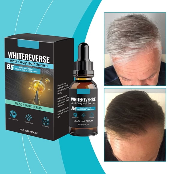 Esencia 30ml Cuidado del Cabello Activa la Melanina Nutre Científicamente el Cabello Ingredientes Naturales solución de cuidado