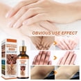 thumbnail image 4 of Suero Blanqueador Aceite Aclarante para Manchas Oscuras en Cuerpo y Nudillos Piel Negra Rodillas y C, 4 of 7