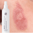 thumbnail image 2 of Briotech Pure Hypochlorous, Premium HOCl, Multi-Purpose Solution, 8 fl oz, 2 of 8