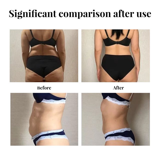 20pc Wonder Patch adelgazamiento vientre Abdomen pérdida de peso mujeres quemador de grasa auspicioso LingWen 8390611484521