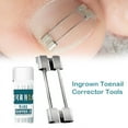 thumbnail image 5 of Ingrown Toenail Corrector Tools Pedicure Recover Embed Toe Nail Treatment Professional Ingrown Toenail Straightening Clip Brace, 5 of 10