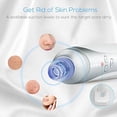thumbnail image 5 of Ginpey Pore Vacuum Cleaner Comedones Extractor with 4 Probes Blackhead Remover Microdermabrasion Device, 5 of 10