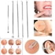 thumbnail image 4 of 5 unidades de herramienta de acero inoxidable para eliminar granos faciales y comedones, 4 of 6