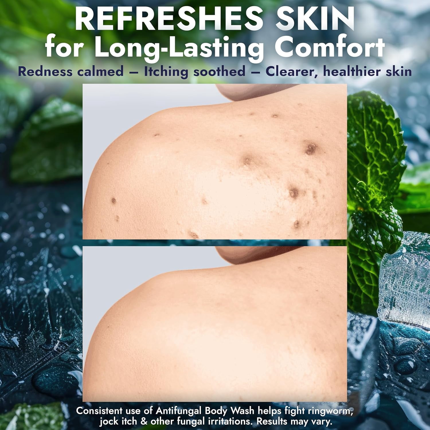 Antifungal Body Wash | Antifungal Soap with 1% Tolnaftate | Medicated Jock Itch Treatment for Ringworm & Athlete’s Foot | Cooling Effect Menthol Body Wash | Includes Scrubber 16.9 Fl oz