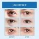 thumbnail image 4 of Crema para ojos con péptido de veneno de serpiente repara las bolsas para los ojos reafirma la piel reduce la hinchazón, diminue las arrugas, formulada con hierbas, 4 of 5