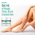thumbnail image 5 of Foot Moisturizes And Moisturizes Feet To Dead Skin And Exfoliates Feet, 5 of 5