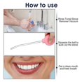 thumbnail image 5 of 3Pcs Tonsil Stone Remover Vacuum Cleaning Tonsil Stone Remover Kit Oral Tonsil Stone Removal Tool M, 5 of 5
