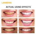 thumbnail image 3 of LANBENA Tiras Blanqueadoras Dentales Azules, Fórmula Suave para una Sonrisa Radiante, Elimina Manchas de Café y Té, Mejora la Higiene Oral, 1 Unidad, 3 of 6