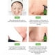 thumbnail image 5 of BREYLEE 17mL Tea Tree Blackhead Mask Suero para el tratamiento del acné + 100pcs Papeles Ehuebsd cuidado belleza, 5 of 5