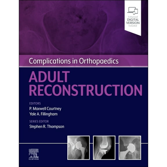Complications in Orthopaedics: Adult Reconstruction, (Hardcover)