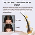 thumbnail image 5 of Clearance Essential oils Essence Oils For Candles OrganicOnion Oil | ControlsHair Loss, Dandruff, & Helps With Growth | Sulfate-Free Hair Care60ml(buy 2 get 10% off), 5 of 5