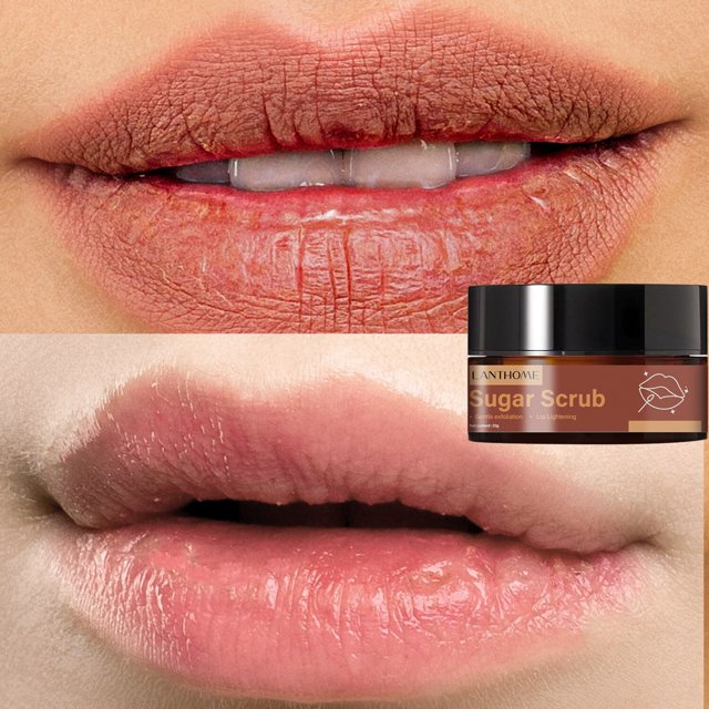 Crema para el cuidado de los labios, exfoliante para eliminar los labios oscuros, bálsamo para aligerar los labios negros, reducir la pigmentación, eliminar las líneas de los labios, reparar y aclarar qym unisex