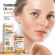 thumbnail image 3 of 1pcs Aceite de limón y cúrcuma, brillo de la piel para aclarar el acné, parches oscuros, acné, piel brillante, Corrector de manchas oscuras, blanqueamiento facial, 3 of 5