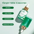 thumbnail image 3 of ANAiRUi Tea Tree Oil with Salicylic Acid, Purifying Facial Oil for Blemish Prone Skin, Care for Face and Back, 1 fl oz, 3 of 9