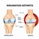 thumbnail image 3 of Muscle & Joint Comfort Roller for Neck, Shoulder, Knee, and Back Support, 3 of 5