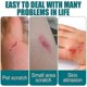 thumbnail image 4 of 3Pcs New Skin Liquid Plaster, Waterproof And Breathable Quick-dry Gel Liquid Bandages For Scrapes/cracked Skin/wounds/dry, 4 of 5