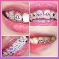 thumbnail image 2 of DIY Tooth Gem Kit with Crystals Jewelry Ornaments Teeth Decoration Tools, 2 of 5