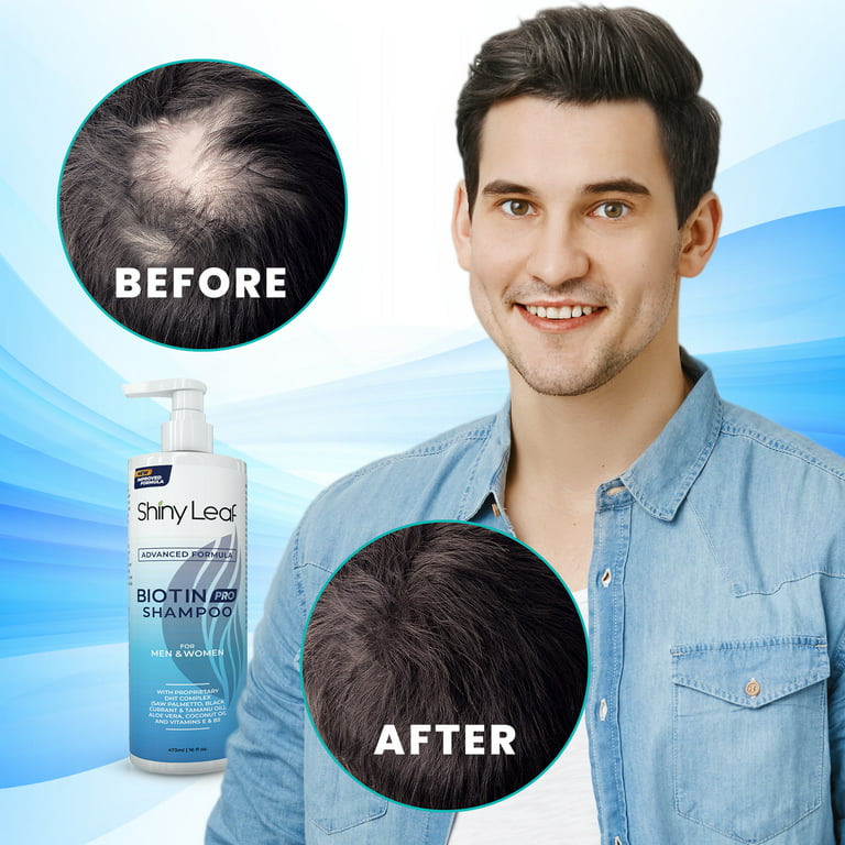 Shiny Leaf Biotin Pro Shampoo for Hair Growth - Sulfate-Free, Paraben-Free, Thickening Shampoo, Hair Shampoo for Men and Women, 16 fl. oz. (2 pack) - Walmart.com