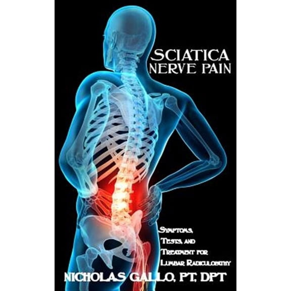 Sciatica Nerve Pain: Symptoms, Tests, and Treatments for Lumbar Radiculopathy (Paperback)