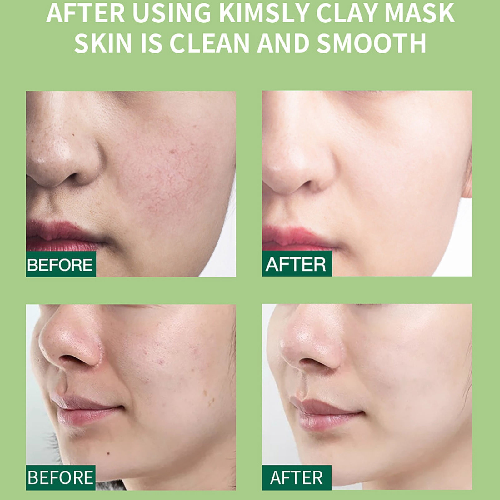 Face Moisturizer for Oily Skin Eye Roller ning Lotion Korean Beauty Mens Face Scrub Ordinary Face Skin Care Face Skin Care Baby & Child Personal Care Products Mens Lotion Face Clear