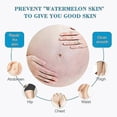 thumbnail image 3 of Anti-stretch Mark Repair Cream For Pregnancy Scar Slack Line Stretch Skin Mark Remover Body Lotion, 3 of 5