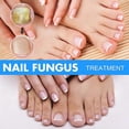 thumbnail image 4 of Nail Fungal Solution, Extra Strong Toenail Fungus Nail Treatment, Fungus Fingernail & Toenail Solution To Renew Damaged Discoloured Toenail, 4 of 5