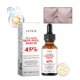 thumbnail image 4 of Fiudx Liquidación De Ahorros De Verano Exfoliante Exfoliante Super Exfoliante Pigmentación Iluminador Antienvejecimiento 30Ml, 4 of 6