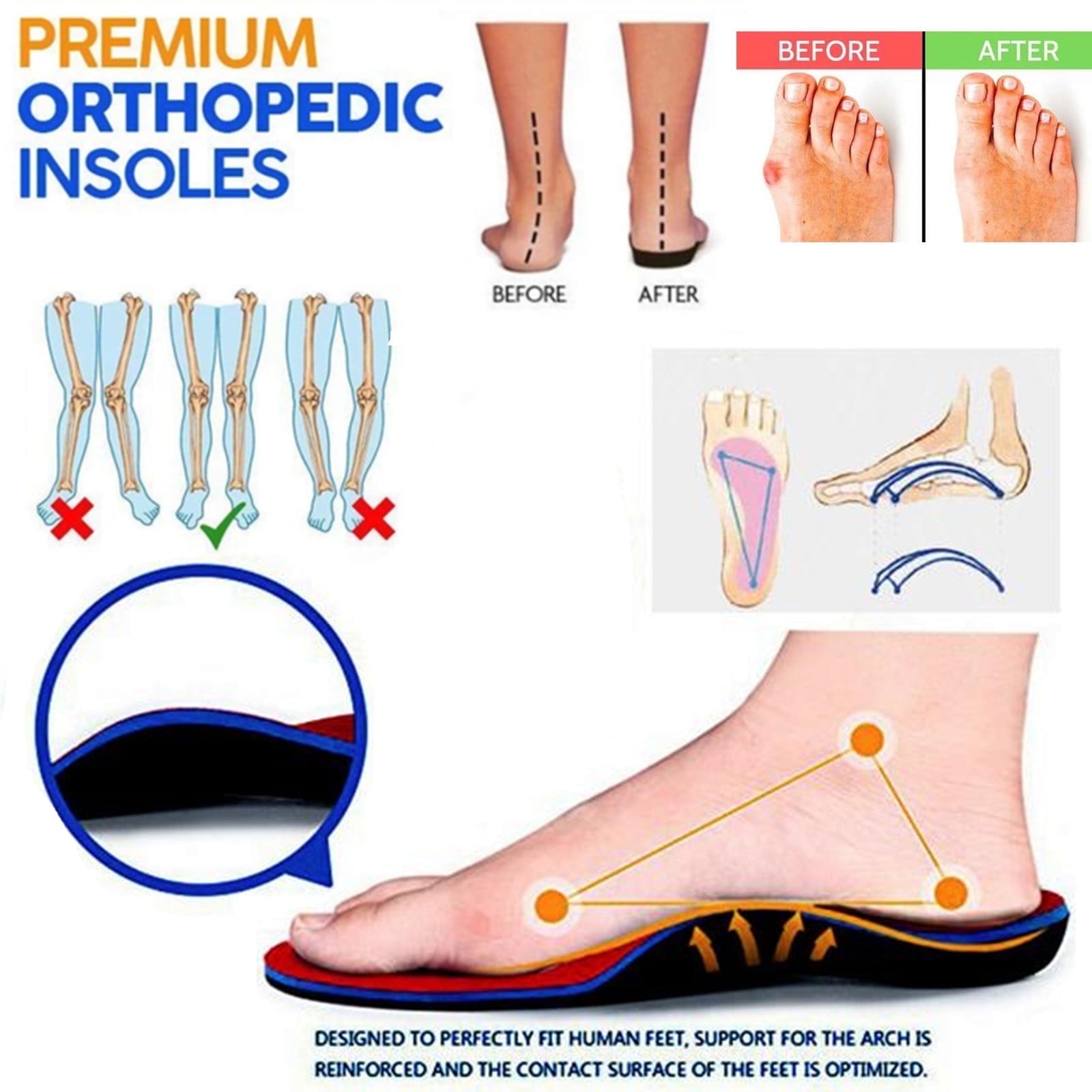 Cameland Orthopedic Sandals For Women Beach Slippers With Arch Support Anti- Breathable Open Toe Vintage Wedge Sandals for Women, Up to 65% off!