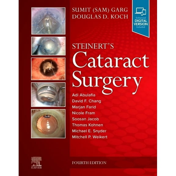 Steinert's Cataract Surgery, (Hardcover)
