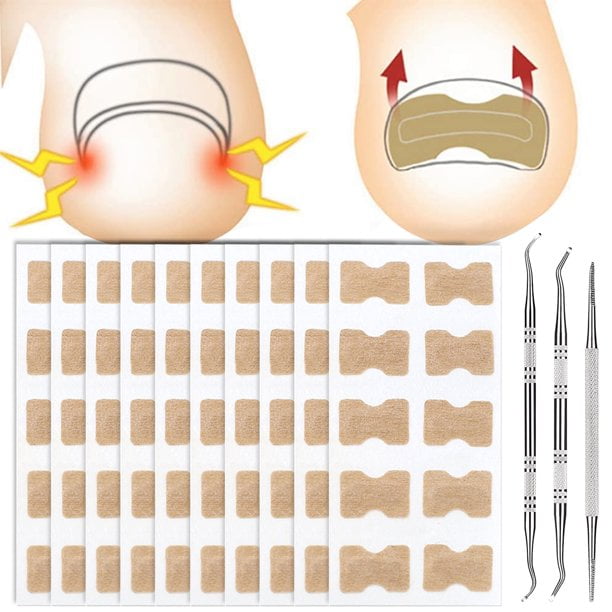 100Pcs Ingrown Toenail Corrector Stickers Breathable Self-Adhesive Toenail Correction Patch Nail Correction Tool