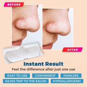 MEDca Deep Cleansing Pore Strips Combo Pack – 48-Count Blackhead Remover Strips for Sensitive Skin Care