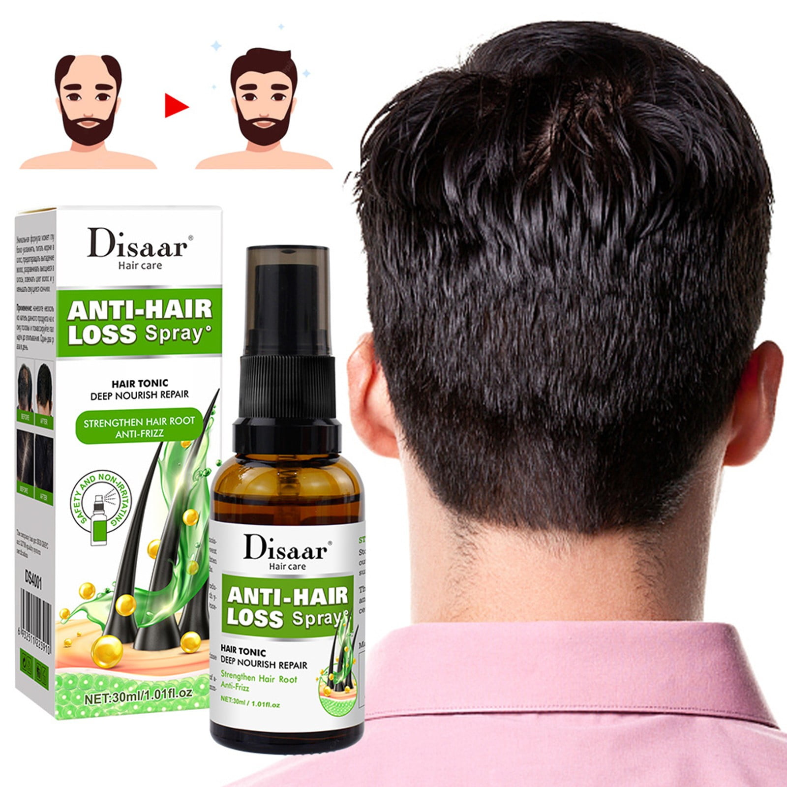 Consumable Hair Growth Advanced Topical Formula To Help Grow Healthys  Strong Hair Suitable For Men And Women Of All Hair Types Hair Loss Support  30ML beauty products - Walmart.com