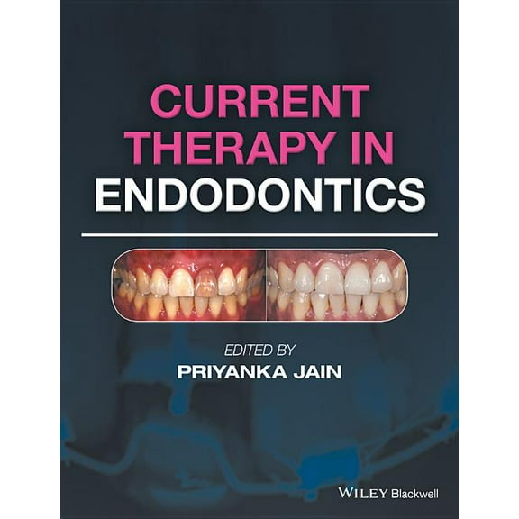 Current Therapy in Endodontics (Hardcover)