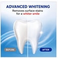 thumbnail image 3 of Colgate Total SF Advanced Whitening Toothpaste, 6.4 Ounce (Pack of 5), 3 of 6