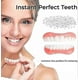 thumbnail image 4 of Advanced Customized Full Denture Set, Silicone Reline Denture Set, 4 of 5