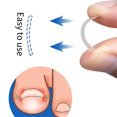 thumbnail image 2 of Guardurnaity Corrector de uñas de 10 piezas, tratamiento de uñas encarnadas, pedicura de uñas para dedos del pie, paroniquia, onicocriptosis, uñas Ayudas para vestirse con gancho de botón Guardurnaity CE001578-00, 2 of 6