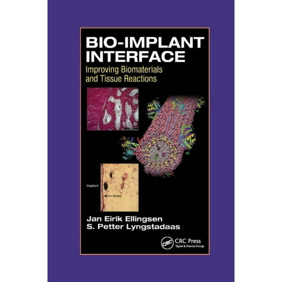 Bio-Implant Interface: Improving Biomaterials and Tissue Reactions, (Paperback)