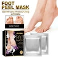 thumbnail image 1 of Fiudx Botitas Exfoliantes, Mascarilla Exfoliante para Piel Muerta, Tratamiento para Pies de Bebé, Reparación de Talones Agrietados, Cuidado de Pies Fácil de Usar, Mimos para Hombres y Mujeres, Fórmul, 1 of 6