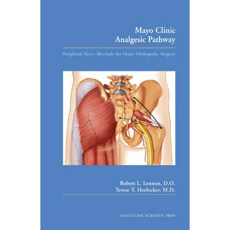 Mayo Clinic Analgesic Pathway : Peripheral Nerve Blockade for Major Orthopedic (Best Orthopedic Surgery Textbook)