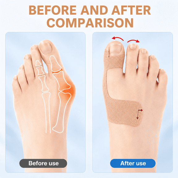 40 Pcs Pre-Cut Bunion Corrector Kinesiology Tap, Self-Adhesive Hallux Valgus Toe Strips for Men & Women, Elastic Breathable& Hypoallergenic Latex-Free Kinesiology Tape