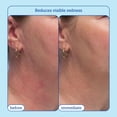 thumbnail image 4 of Crema Skinfix Barrier+ Triple Lípido-Péptido 50 ml, 4 of 8