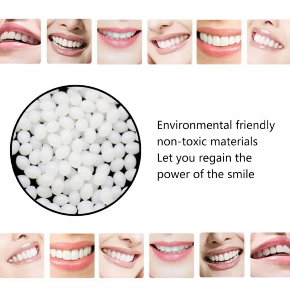 Balems Temporary Tooth Repair Kit-Thermal Beads for Filling Fix Missing/Broken Teeth