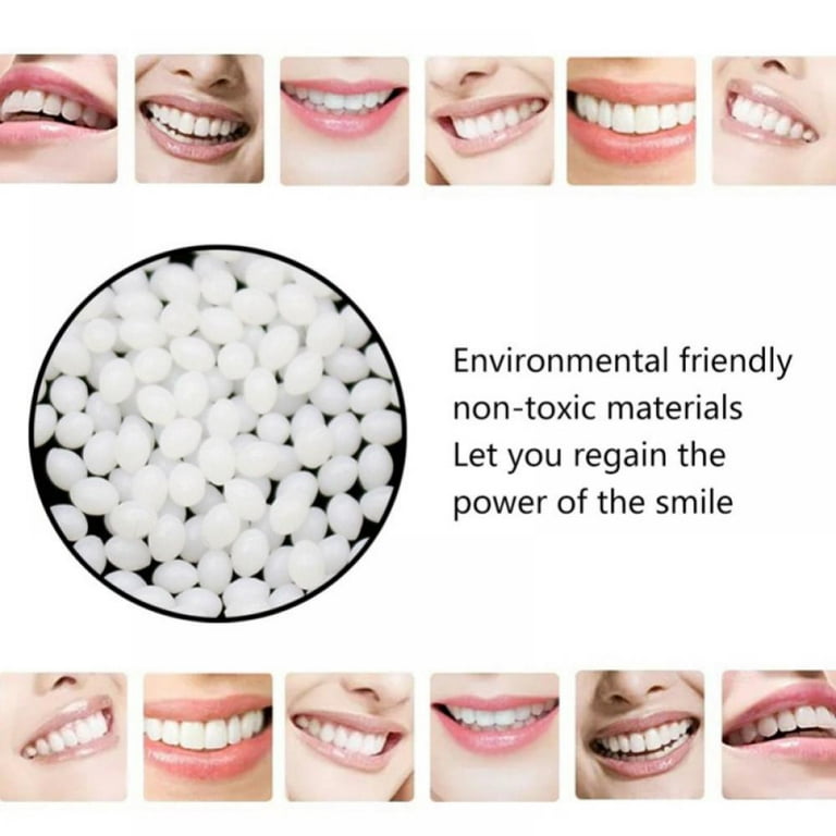 Thermal Fitting Beads - Custom Fitting Beads - Instant Smile